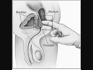 Минет и массаж простаты: 1000 видео